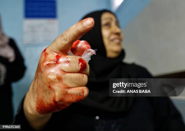 Graphic content / A Palestinian woman injured by Israeli air strikes gestures with her bloodied hand as she sits after receiving treatment at...