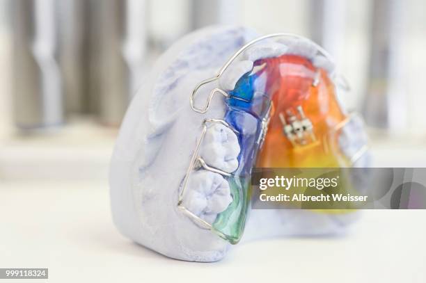 model of dentures on a plaster cast, germany - valentin yudashkin paris stockfoto's en -beelden