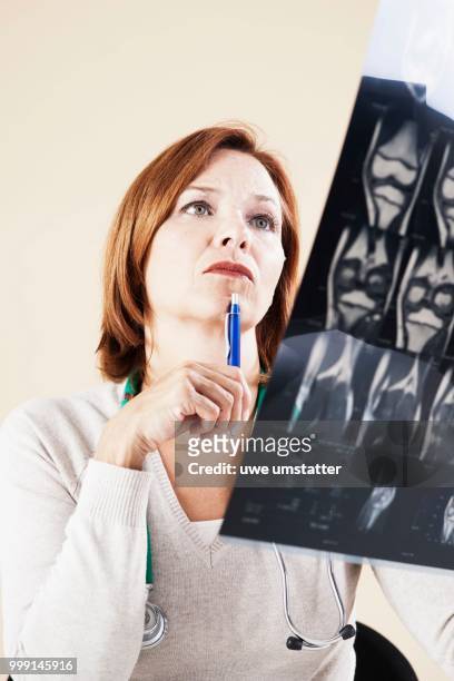 female doctor looking at an x-ray, mannheim, baden-wuerttemberg, germany - diagnosed stock pictures, royalty-free photos & images