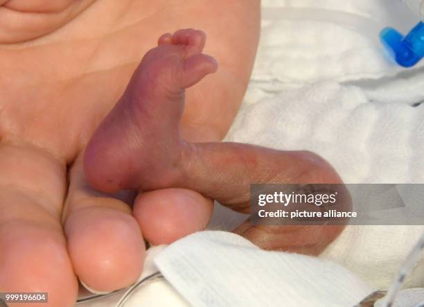 The right foot of a five-day old boy weighing 430 grams at birth photographed in the hands of a caregiver in the pediatric clinic of the Hannover...