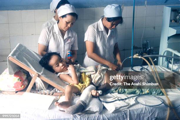 Conjoined twins Viet and Duc Nguyen receive treatment on June 19, 1986 in Ho Chi Minh, Vietnam.