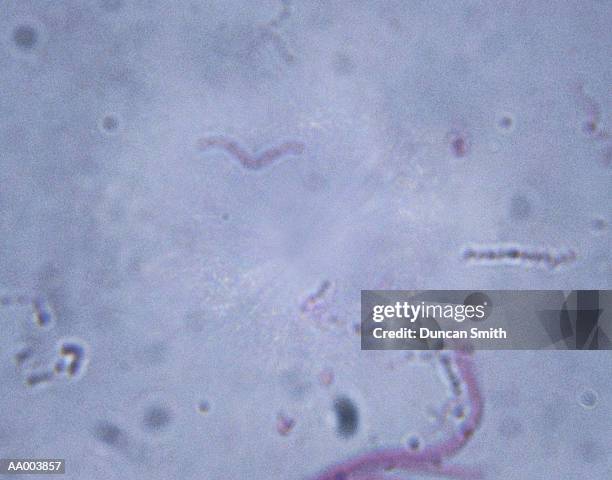 microscopic image of spirillum volutans - spirillum stockfoto's en -beelden