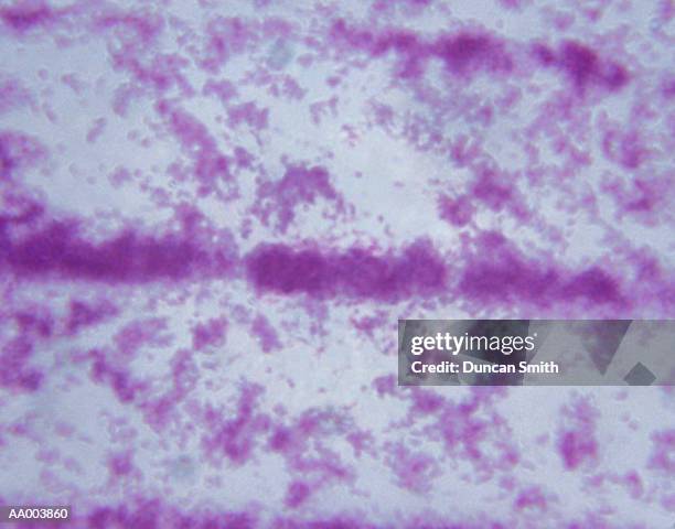 microscopic image of mycobacterium tuberculosis - mycobacterium stock pictures, royalty-free photos & images