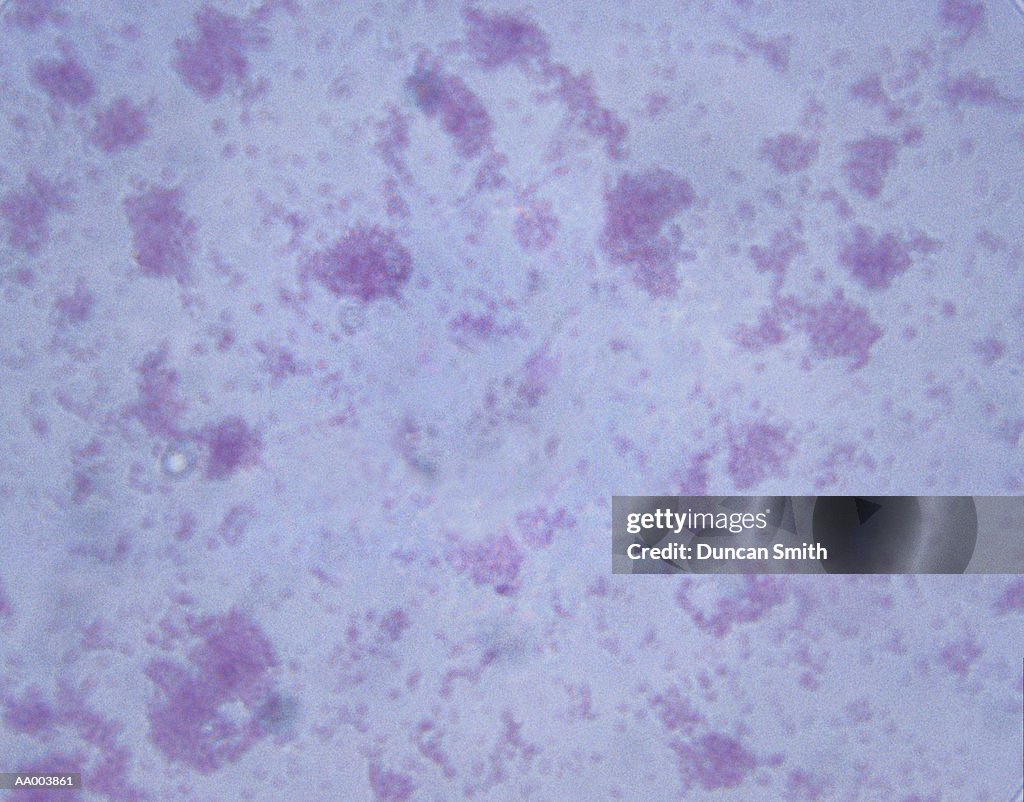Microscopic Image of Escherichia Coli