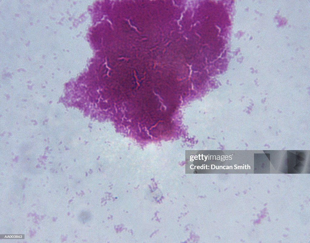 Microscopic Image of Agrobacterium Tumefaciens