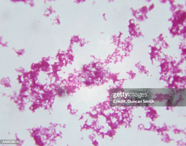 microscopic image of yersinia pestis - prokaryote stock pictures, royalty-free photos & images