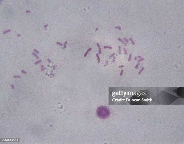 microscopic image of chromosomes - alta magnificação - fotografias e filmes do acervo