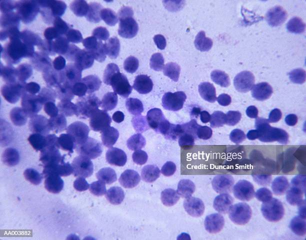 microscopic image of male chromosomes - alta magnificação - fotografias e filmes do acervo