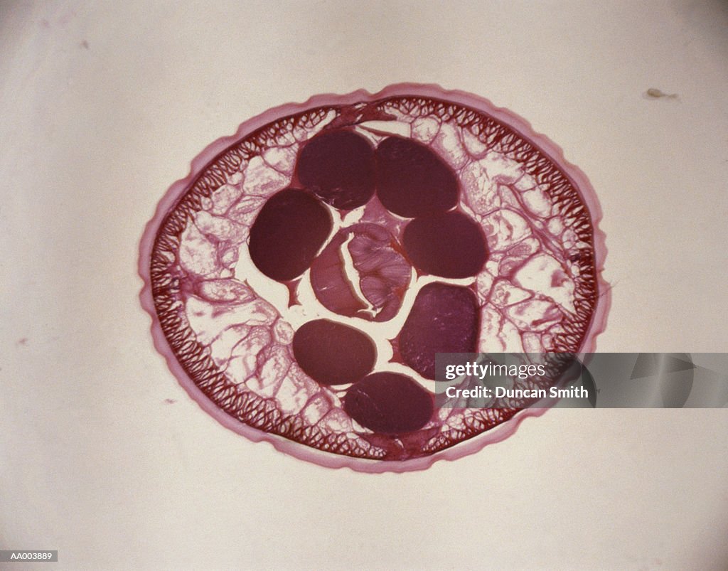 Microscopic Crosssection Of A Roundworm High-Res Stock Photo - Getty Images