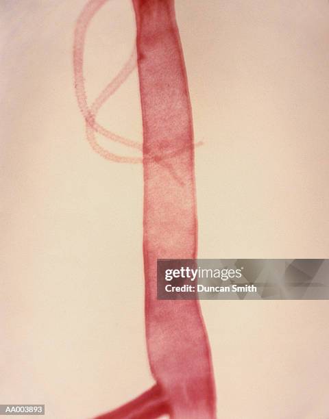 microscopic image of a hydra with bud - hydra bildbanksfoton och bilder
