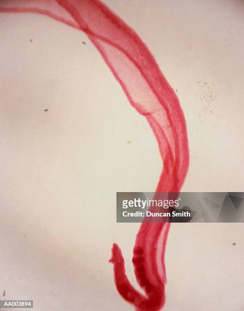 blood fluke - schistosoma stock pictures, royalty-free photos & images