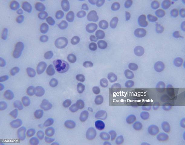 microscopic image of pernicious anemia - sterk-uitvergroot stockfoto's en -beelden