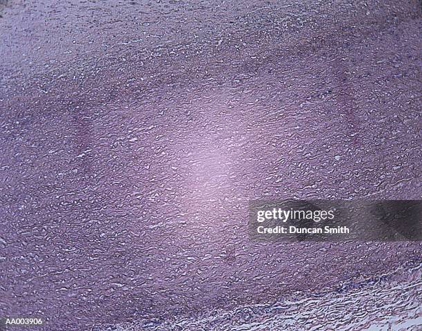 microscopic image of a coronary artery - artère humaine photos et images de collection