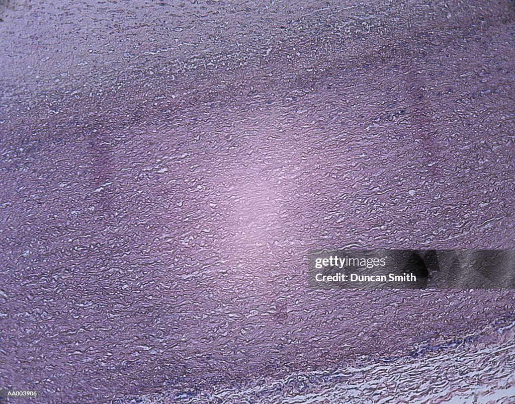 Microscopic Image of a Coronary Artery