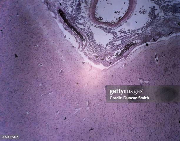 Ulcernic Nic Photos and Premium High Res Pictures - Getty Images