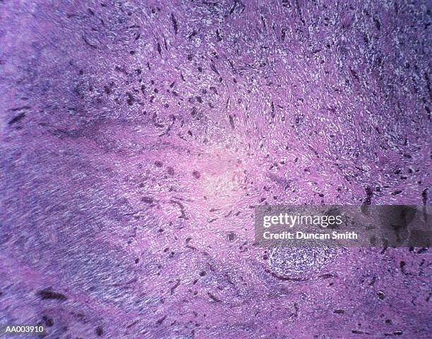 microscopic image of diseased lung tissue - alta magnificação - fotografias e filmes do acervo