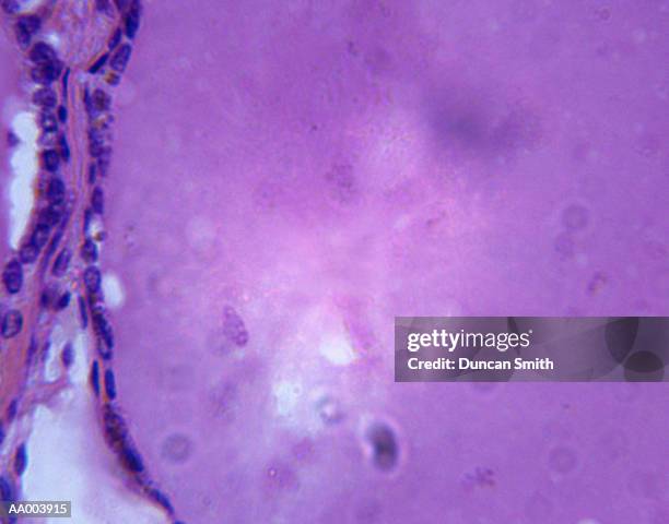 microscopic image of a thyroid gland - parte de organismo vivo imagens e fotografias de stock