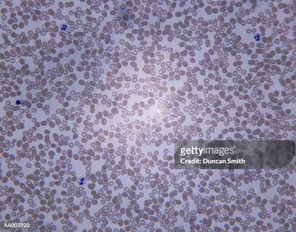 microscopic image of human blood - alta magnificação - fotografias e filmes do acervo