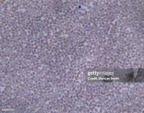 Cat Rbc Under Microscope 5,832 Dic Stock Photos, High-Res Pictures, and Images - Getty Images