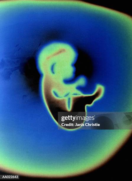 three month old human fetus - 12 week fetus stock pictures, royalty-free photos & images