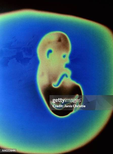 five month old human fetus - 20 week foetus stock pictures, royalty-free photos & images