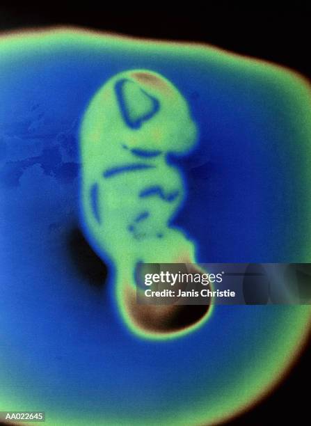 seven month old human fetus - foetus de 32 semaines photos et images de collection