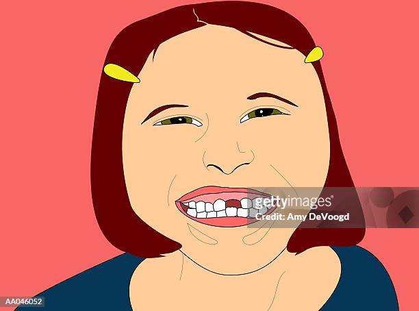 Girl With Missing Tooth High-Res Vector Graphic - Getty Images