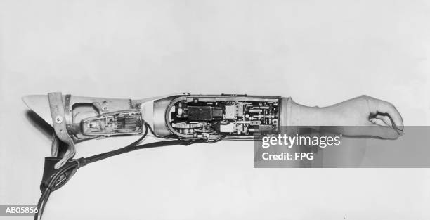 prosthetic arm showing interior mechanisms (b&w) - archive 2005 stock-fotos und bilder