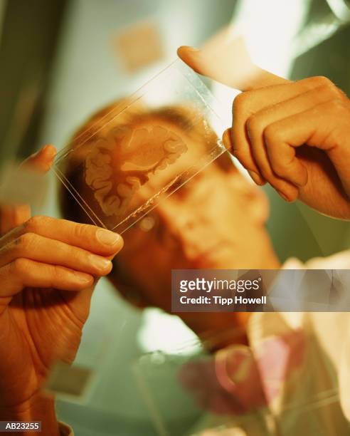 medical worker examining biopsy sample, low angle  (focus on sample) - biopsy - fotografias e filmes do acervo