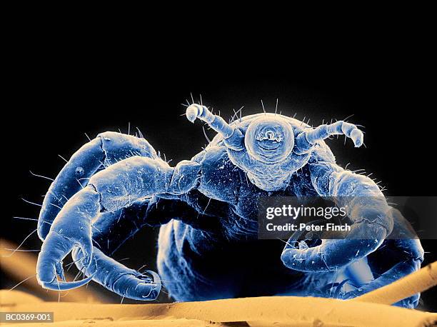 sem of human head louse x55 (colour enhanced) - micrografía electrónica escaneadora fotografías e imágenes de stock