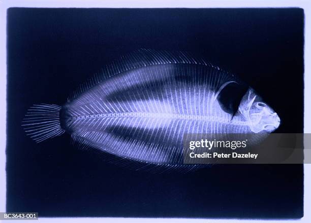 x-ray of dover sole (solea vulgaris) (toned b&w) - crazy ray ray stock pictures, royalty-free photos & images