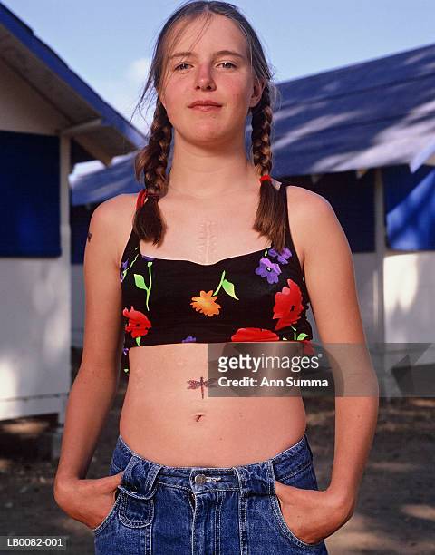 teenage girl (16-18) with heart surgery scar, portrait - heart scar stockfoto's en -beelden