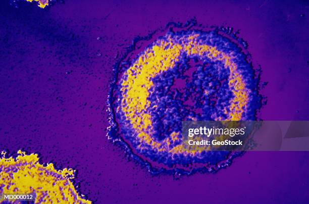 microscopic hiv virus - sterk-uitvergroot stockfoto's en -beelden