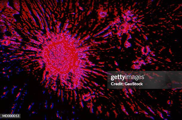 microscopic cancer cell - sterk-uitvergroot stockfoto's en -beelden