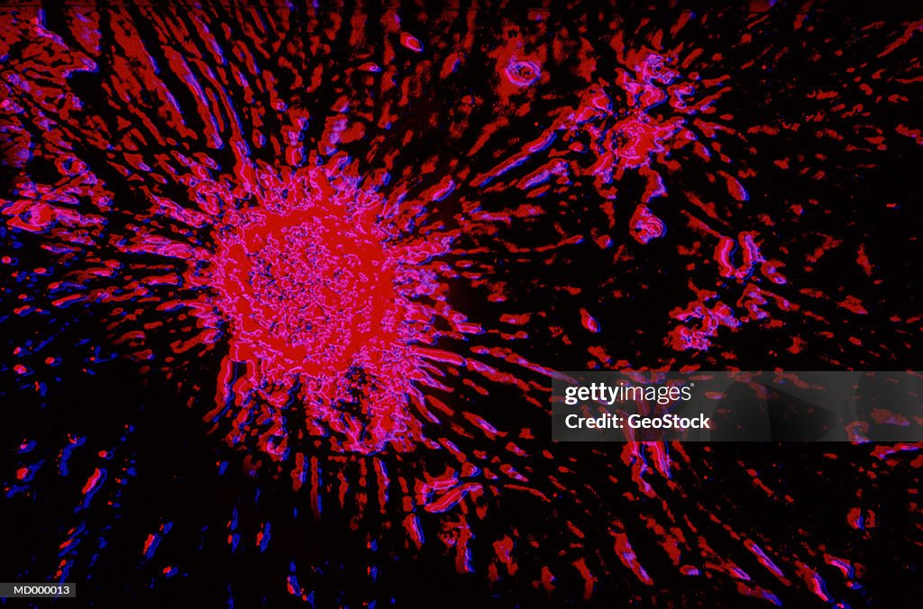 Microscopic Cancer Cell