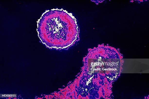 microscopic hiv virus - alta magnificação - fotografias e filmes do acervo