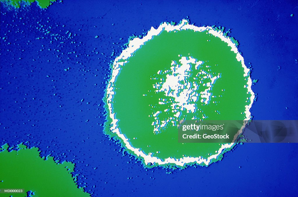 Microscopic HIV Virus