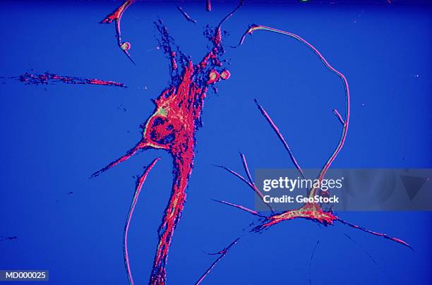microscopic neuron - alta magnificação - fotografias e filmes do acervo