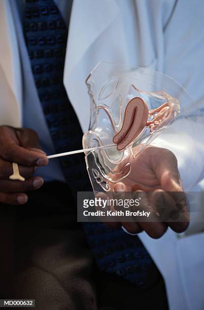 doctor holding a model of a uterus - anatomista fotografías e imágenes de stock