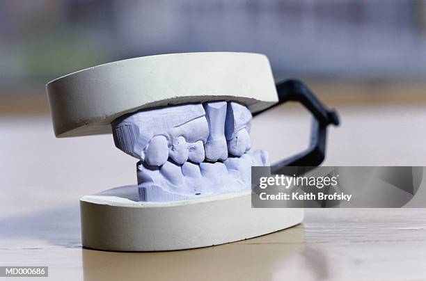plaster dental mold - dental mould stock pictures, royalty-free photos & images