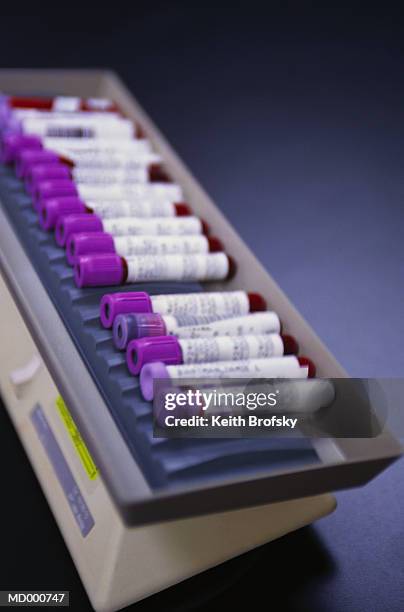 test tubes filled with blood - test tube rack stock pictures, royalty-free photos & images