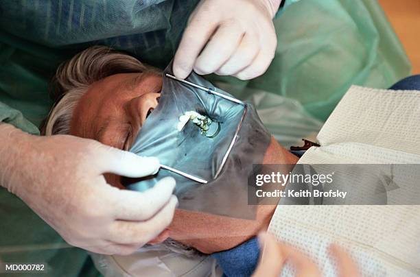 dentist using a dental dam over a patient's mouth - デンタルダム ストックフォトと画像