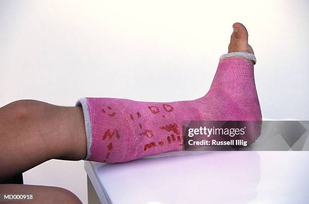 broken leg - cast of amcs low winter sun q a with art house convergence stockfoto's en -beelden