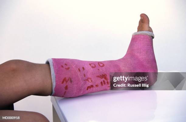 2,949 Pink Cast Stock Photos, High-Res Pictures, and Images - Getty Images