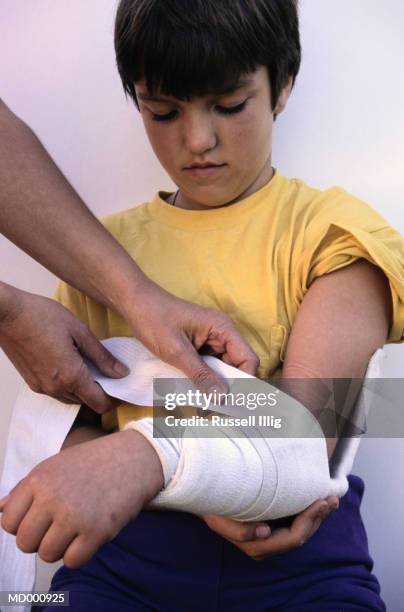 girl with broken arm - behind the scenes of the cast of jackass spoofing the best picture nominees for the 16th annual critics choice movie awards stockfoto's en -beelden