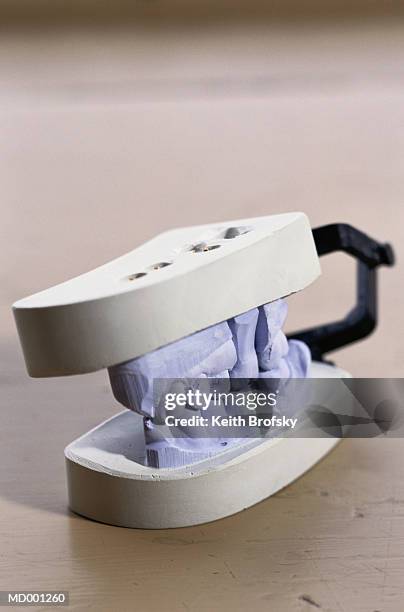 dental mold - dental mould stock pictures, royalty-free photos & images