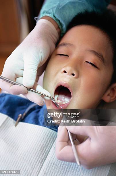 boy at dentist - rimotore di placca foto e immagini stock