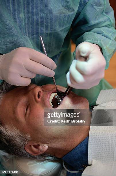 tooth cleaning - man mouth open stock pictures, royalty-free photos & images