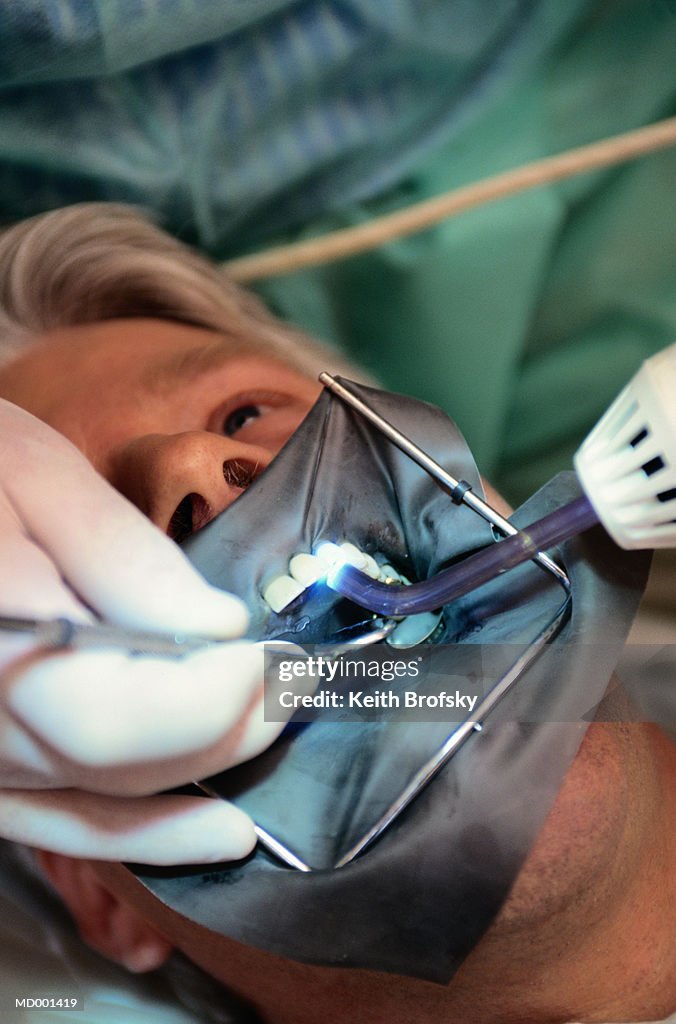 Tooth Cleaning with Dental Dam