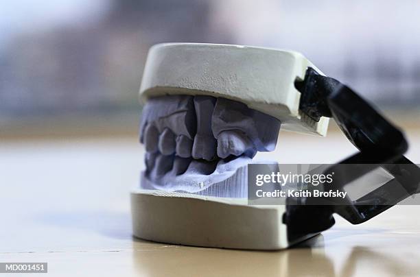 model of teeth - molde dental fotografías e imágenes de stock